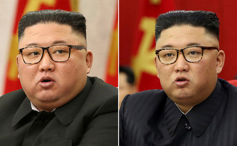 Ο Κιμ Γιονγκ Ουν έχει χάσει 20 κιλά &#8211; Τι λένε οι κατάσκοποι της Νότιας Κορέας για την υγεία του