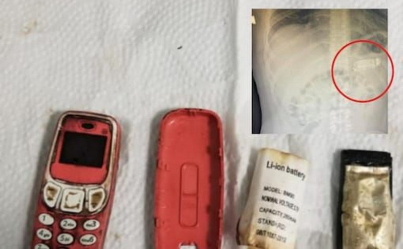 Κόσοβο: Κρατούμενος είχε στο στομάχι του επί 4 μέρες ένα κινητό τηλέφωνο