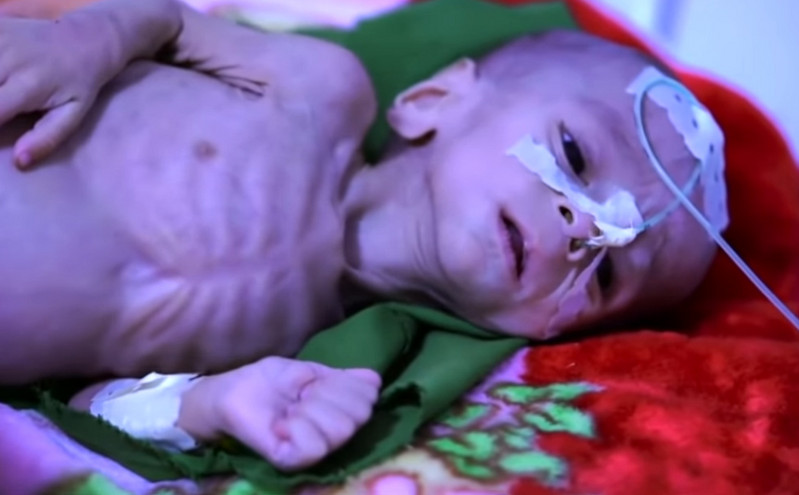 Εικόνες – γροθιά στο στομάχι από τον εφιάλτη στο Αφγανιστάν: «Πουλήσαμε το μωρό μας 500 δολάρια για να φάμε»
