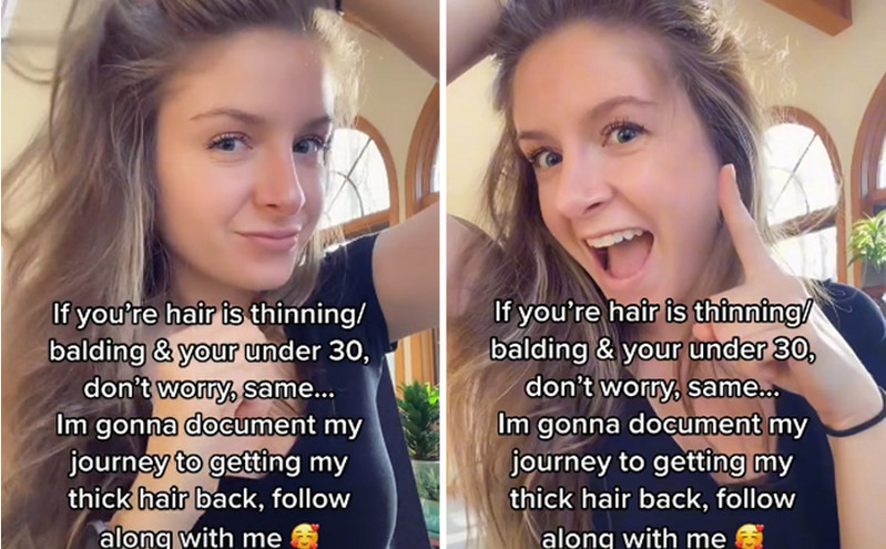 TikToker εξηγεί γιατί μάλλον λούζετε τα μαλλιά σας λάθος μέχρι σήμερα