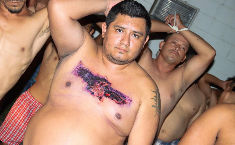 Ελ Σαλβαδόρ: Γιατί μέλη συμμοριών καίνε τα τατουάζ τους