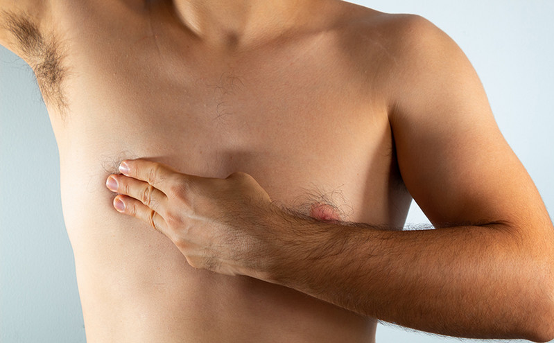 Επιθετικός καρκίνος του μαστού στους άνδρες: Πώς σχετίζεται με την υπογονιμότητα