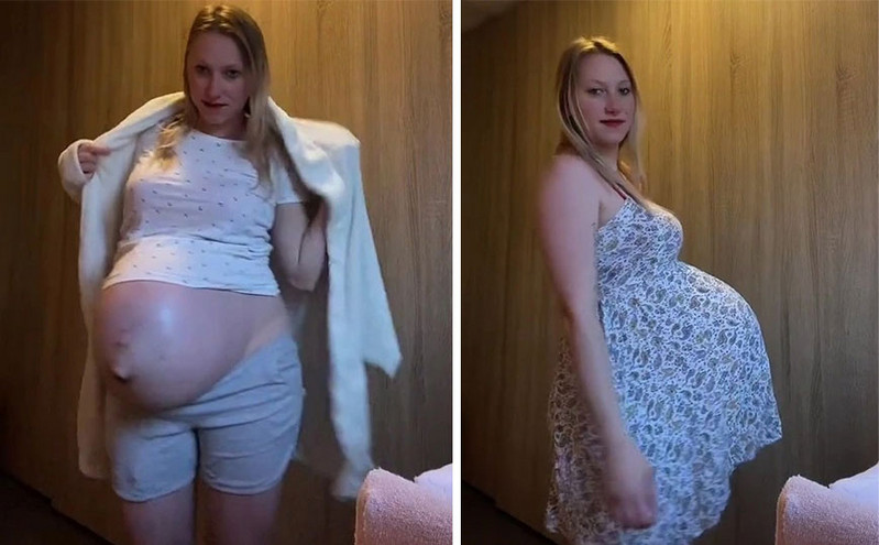 Είναι έγκυος σε ένα παιδί, όμως έχει τρομακτικά τεράστια κοιλιά – «Μπορεί να χωρέσει έναν άντρα»
