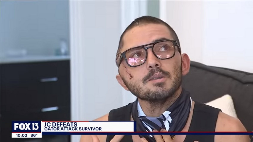 Φλόριντα: Δέχθηκε επίθεση από αλιγάτορα που του δάγκωσε το κεφάλι και επέζησε