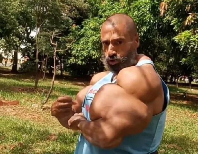 Ο Βραζιλιάνος «Hulk» πέθανε στα 55 του – Έκανε ενέσεις λαδιού για να «φουσκώσει» τους μύες του