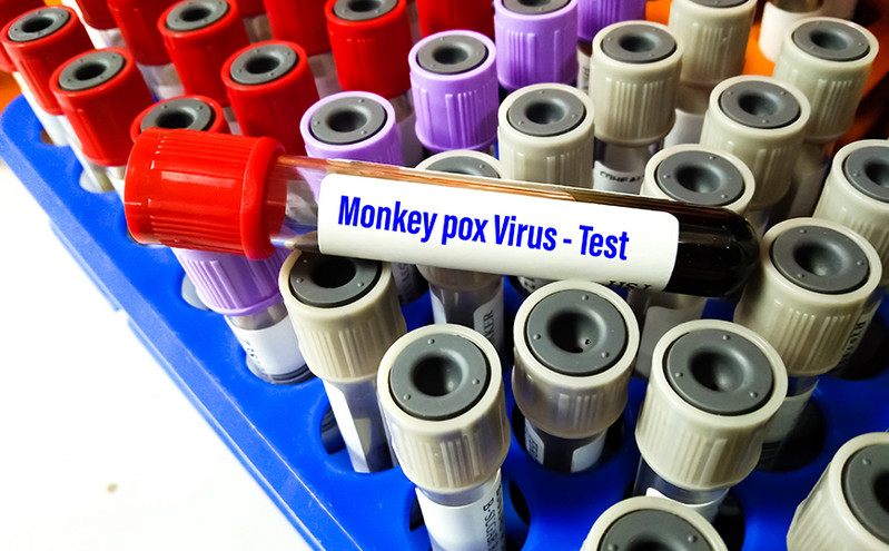 Ευλογιά των Πιθήκων: Ο ΠΟΥ αλλάζει το όνομά της σε «mpox &#8211; Παράπονα για ρατσιστική χρήση του «monkeypox»