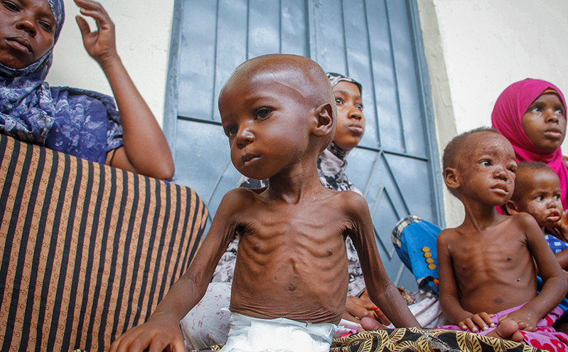 Τραγωδία δίχως τέλος στη Σομαλία: Εξαντλημένα από την πείνα, τα παιδιά δεν έχουν δύναμη ούτε να κλάψουν