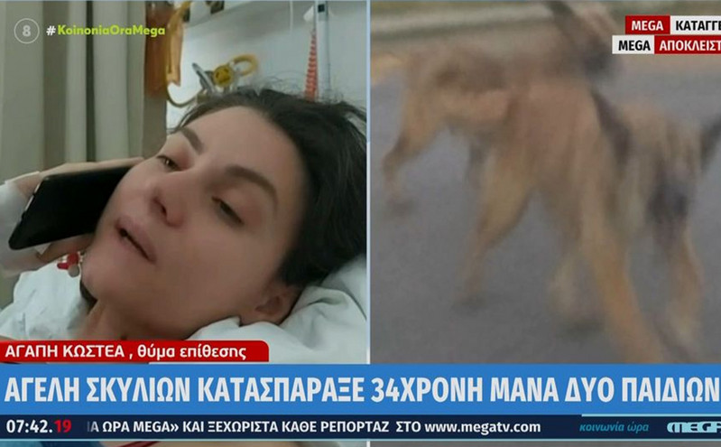 H 34χρονη που δέχτηκε επίθεση από αγέλη σκύλων μιλάει από το νοσοκομείο: «Πρέπει να έχω δύναμη για τα παιδιά μου»