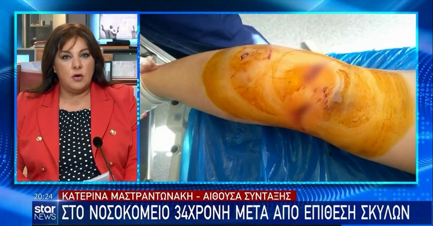 Καλαμάτα: Αγέλη σκύλων όρμηξε με μανία σε 34χρονη έξω από τη δουλειά της