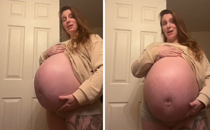 Είναι έγκυος 37 εβδομάδων και η κοιλιά της φτάνει μέχρι το στήθος – Κανείς δεν πιστεύει αυτό που βλέπει