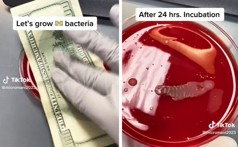 Ερευνητής αποκαλύπτει τα βακτήρια που κρύβονται στο σπίτι &#8211; Χαρτονόμισμα είχε πάνω του σταφυλόκοκκο