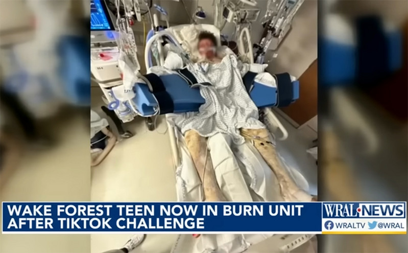 ΗΠΑ: Έφηβος τυλίχθηκε στις φλόγες εξαιτίας μιας πρόκλησης στο TikTok