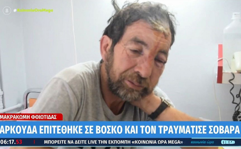 Συγκλονίζει ο βοσκός που δέχτηκε επίθεση από αρκούδα: «Περπάταγα και πήδηξε στο κεφάλι μου»