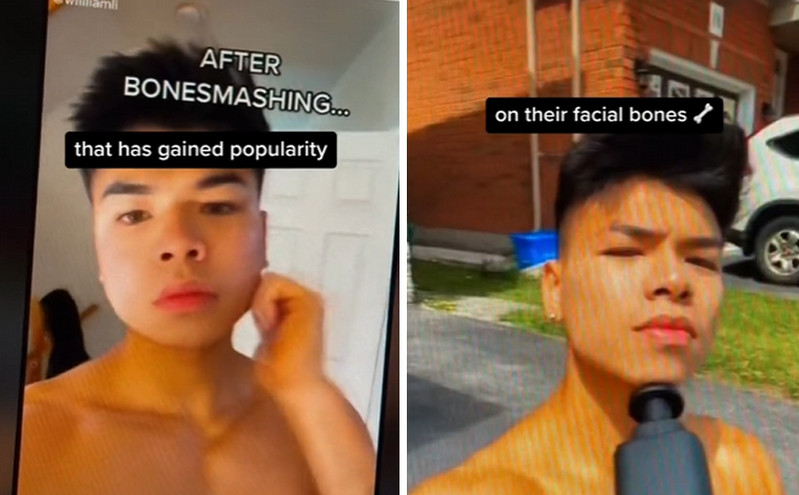 «Μην σπάτε σκόπιμα τα οστά στο πρόσωπό σας» &#8211; Πώς το «bone smashing» επηρεάζει τα νεαρά αγόρια στο TikTok