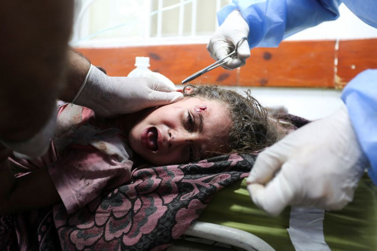 Περισσότεροι από 20.000 τραυματίες παραμένουν στη Λωρίδα της Γάζας και έχουν περιορισμένη πρόσβαση σε ιατρική περίθαλψη