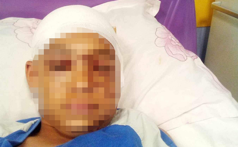 Συγκλονίζει ο πατέρας του 11χρονου που δέχτηκε επίθεση από πίτμπουλ: «Έδωσε μάχη, έκανε 3 ώρες χειρουργείο» λέει στο Newsbeast