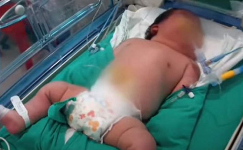 Το βαρύτερο παιδί στον κόσμο γεννήθηκε στην Χιλή και ζυγίζει 7.105 γραμμάρια